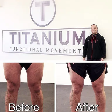 Result Knees